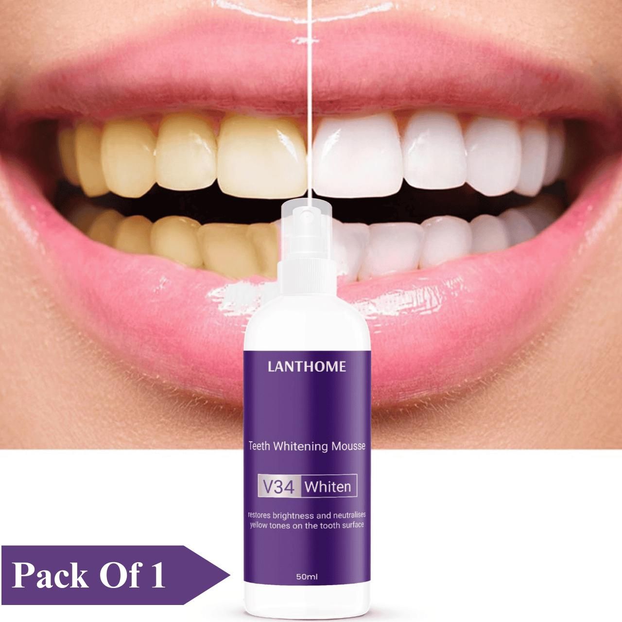 Lanthome Teeth Whitening Spray Mousse V34 Whiten 50ml (Pack Of 1)