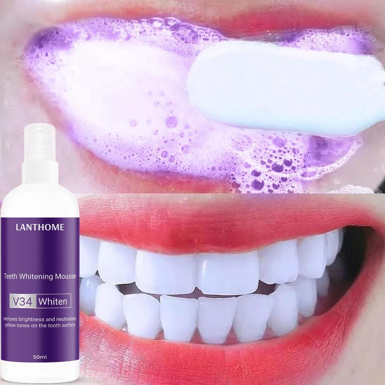 Lanthome Teeth Whitening Spray Mousse V34 Whiten 50ml (Pack Of 1)