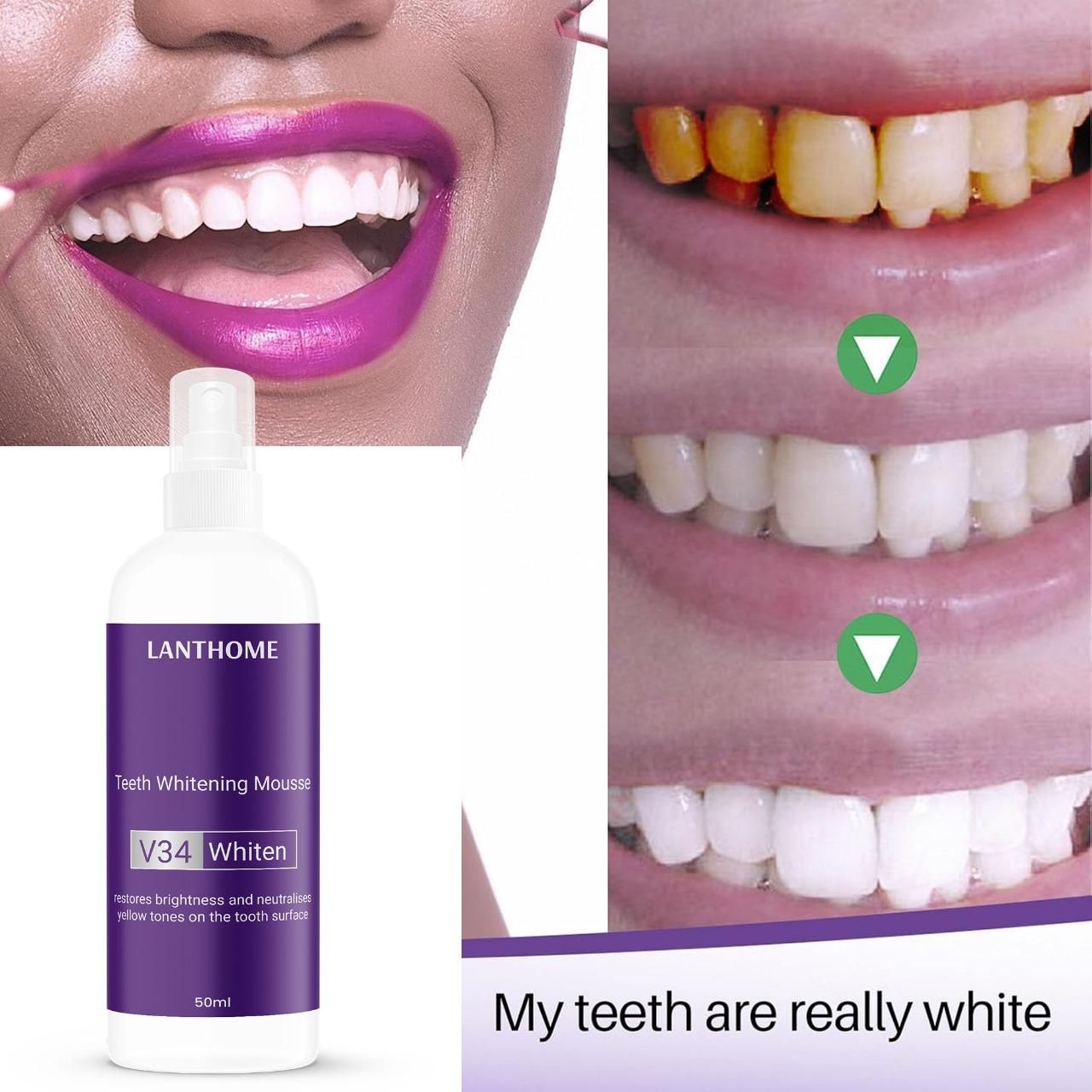 Lanthome Teeth Whitening Spray Mousse V34 Whiten 50ml (Pack Of 1)